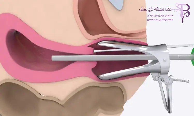 آیا جراحی هیستروسکوپی عوارض دارد؟