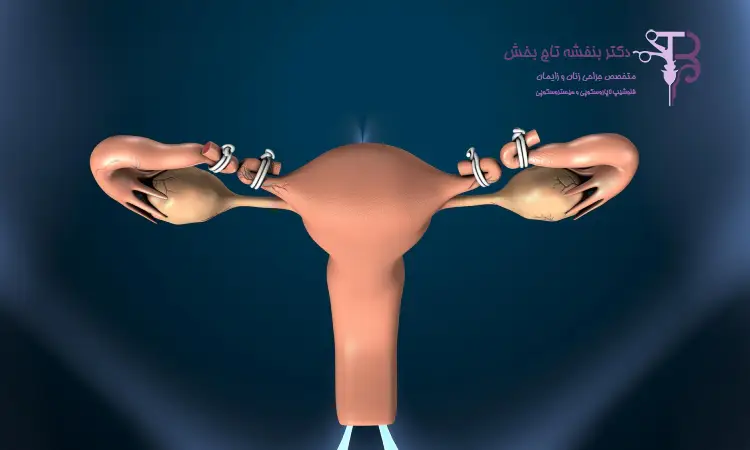 عوامل موثر بر هزینه عمل هیستروسکوپی