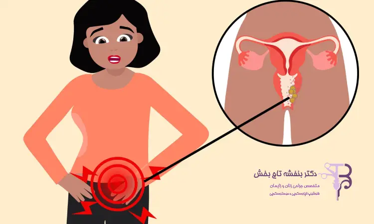 هزینه عمل هیستروسکوپی با بیمه