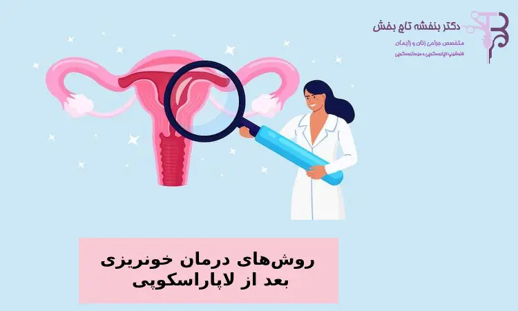 ترشحات واژن بعد از جراحی لاپاراسکوپی
