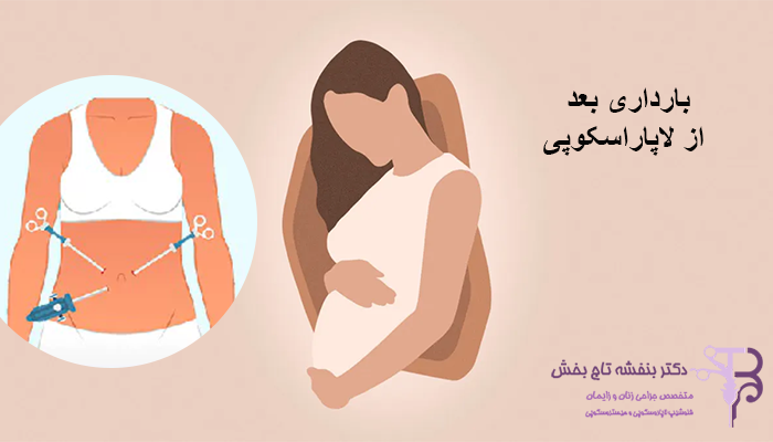 تاثیرات لاپاراسکوپی بر بارداری