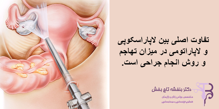 تفاوت لاپاراسکوپی و لاپاراتومی