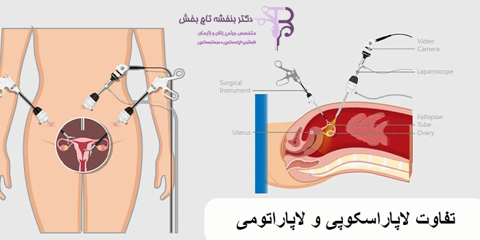 تفاوت لاپاراسکوپی و لاپاراتومی در نحوه انجام آن‌ها