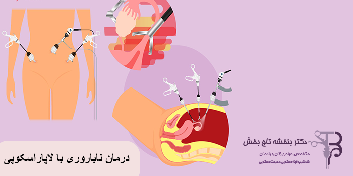 آیا جراحی لاپاراسکوپی برای درمان نازایی خطرناک است؟