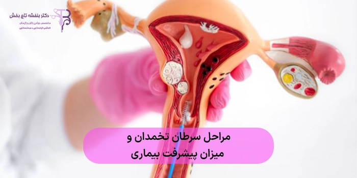 مراحل سرطان تخمدان و میزان پیشرفت بیماری