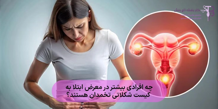 چه افرادی بیشتر در معرض ابتلا به کیست شکلاتی تخمدان هستند؟