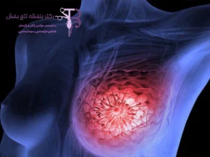 فیبروکیستیک - شاخص