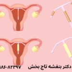 جراحی-هیستروسکوپی