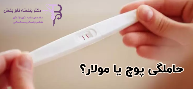 نشانه‌های حاملگی مولار