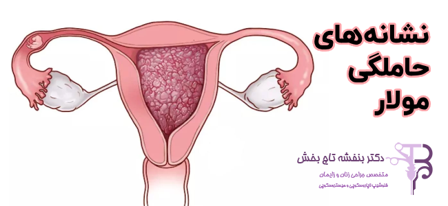 نشانه‌های حاملگی مولار