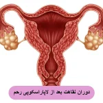 نقاهت بعد از لاپاراسکوپی