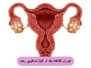 نقاهت بعد از لاپاراسکوپی