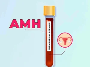آزمایش AMH